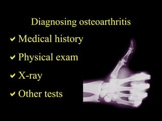 Medical history
Physical exam
X-ray
Other tests
Diagnosing osteoarthritis
 