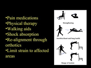 •Pain medications
•Physical therapy
•Walking aids
•Shock absorption
•Re-alignment through
orthotics
•Limit strain to affected
areas
 