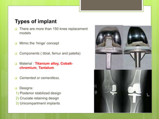 Types of implant
 There are more than 150 knee replacement
models
 Mimic the ‘hinge’ concept
 Components ( tibial, femur and patella)
 Material : Titanium alloy, Cobalt-
chromium, Tantalum
 Cemented or cementless.
 Designs:
1) Posterior stabilized design
2) Cruciate retaining design
3) Unicompartment implants
 