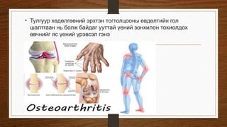 Osteoarthritis | PPT