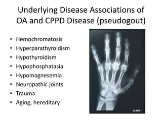 Underlying Disease Associations of
OA and CPPD Disease (pseudogout)
• Hemochromatosis
• Hyperparathyroidism
• Hypothyroidism
• Hypophosphatasia
• Hypomagnesemia
• Neuropathic joints
• Trauma
• Aging, hereditary
 