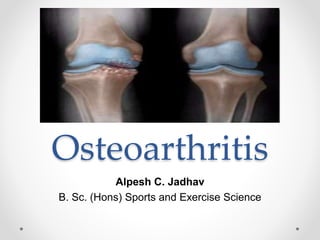 Osteoarthritis
Alpesh C. Jadhav
B. Sc. (Hons) Sports and Exercise Science
 