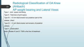 Knee joint Osteoarthritis | PPTX