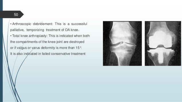 Textbook Of Orthopaedics By John Ebenezer Free