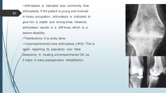 Textbook Of Orthopaedics By John Ebenezer Free