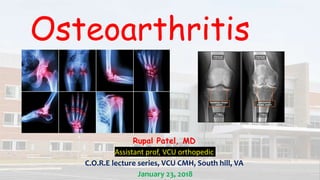 Osteoarthritis
Rupal Patel, MD
Assistant prof, VCU orthopedic
C.O.R.E lecture series, VCU CMH, South hill, VA
January 23, 2018
 