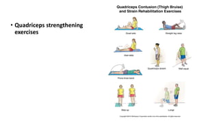 • Quadriceps strengthening
exercises
 