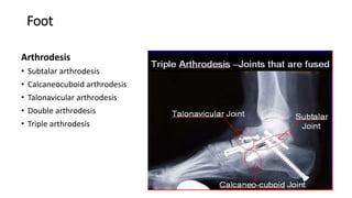 Foot
Arthrodesis
• Subtalar arthrodesis
• Calcaneocuboid arthrodesis
• Talonavicular arthrodesis
• Double arthrodesis
• Triple arthrodesis
 