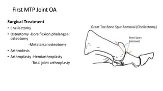 First MTP Joint OA
Surgical Treatment
• Cheilectomy
• Osteotomy -Dorsiflexion phalangeal
osteotomy
-Metatarsal osteotomy
• Arthrodesis
• Arthroplasty -Hemiarthroplasty
-Total joint arthroplasty
 