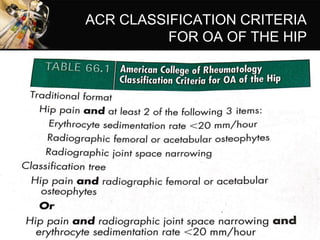 ACR CLASSIFICATION CRITERIA
FOR OA OF THE HIP
 