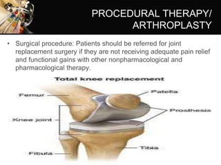 PROCEDURAL THERAPY/
ARTHROPLASTY
• Surgical procedure: Patients should be referred for joint
replacement surgery if they are not receiving adequate pain relief
and functional gains with other nonpharmacological and
pharmacological therapy.
 
