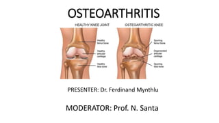 OSTEOARTHRITIS
PRESENTER: Dr. Ferdinand Mynthlu
MODERATOR: Prof. N. Santa
 