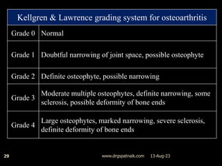 13-Aug-23
www.drgspatnaik.com
29
Kellgren & Lawrence grading system for osteoarthritis
Grade 0 Normal
Grade 1 Doubtful narrowing of joint space, possible osteophyte
Grade 2 Definite osteophyte, possible narrowing
Grade 3
Moderate multiple osteophytes, definite narrowing, some
sclerosis, possible deformity of bone ends
Grade 4
Large osteophytes, marked narrowing, severe sclerosis,
definite deformity of bone ends
 