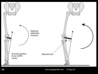 13-Aug-23
www.drgspatnaik.com
35
 