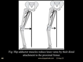 13-Aug-23
www.drgspatnaik.com
60
Fig: Hip adductor muscles reduce knee varus by their distal
attachment to the proximal femur.
 