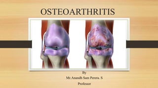 OSTEOARTHRITIS
By
Mr.Anandh Sam Perera. S
Professor
 