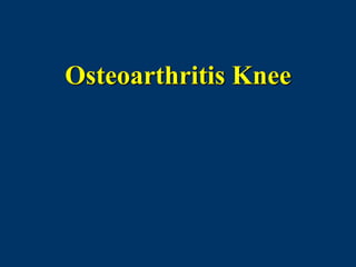 Osteoarthritis Knee
 