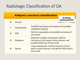 osteoarthritis.pptx apresentation on medicine | PPTX