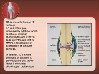 OA is primarily disease of
cartilage.
Il-1 is a potent pro-
inflammatory cytokine, which
capable of inducing
chondrocytes and synovial
cells to synthesize MMPs.
MMPs is responsible of
degradation of articular
cartilage.
In addition, IL-1 inhibits
synthesis of collagen II,
proteoglycans and growth
factor B stimulated
chondrocyte proliferation
 