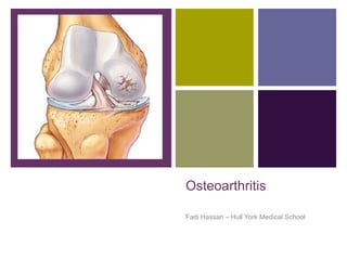 +
Osteoarthritis
Fadi Hassan – Hull York Medical School
 