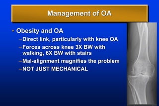 Management of OA
• Obesity and OA
–Direct link, particularly with knee OA
–Forces across knee 3X BW with
walking, 6X BW with stairs
–Mal-alignment magnifies the problem
–NOT JUST MECHANICAL
 