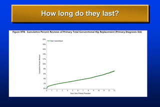 How long do they last?
 