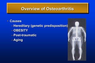 Overview of Osteoarthritis
• Causes
–Hereditary (genetic predisposition)
–OBESITY
–Post-traumatic
–Aging
 