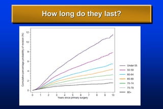 How long do they last?
 