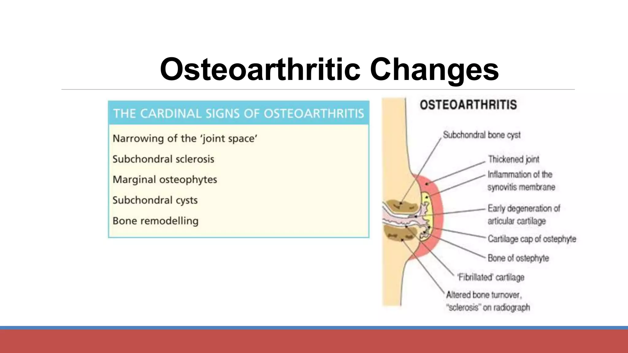 Osteoarthritic Changes
 