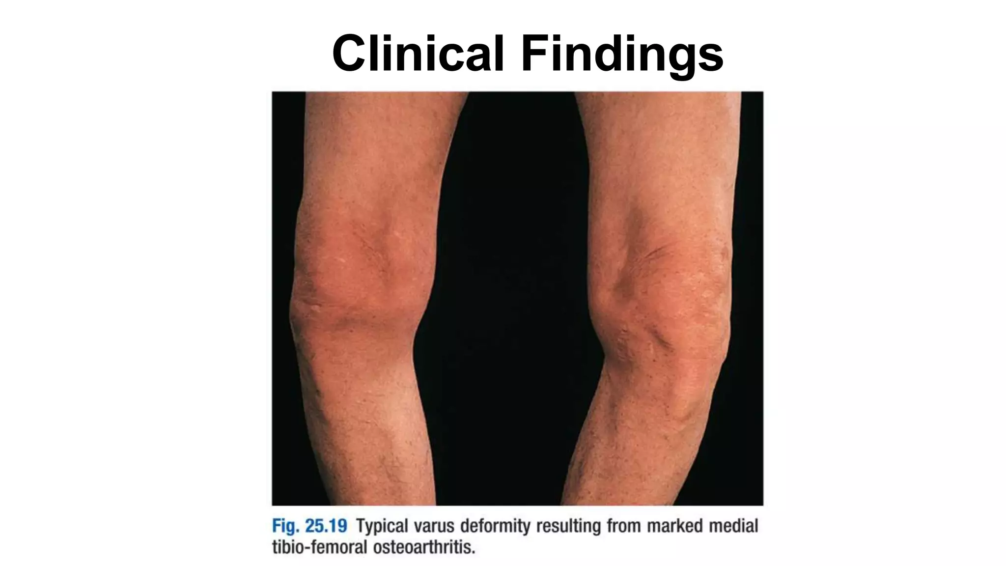 Clinical Findings
 