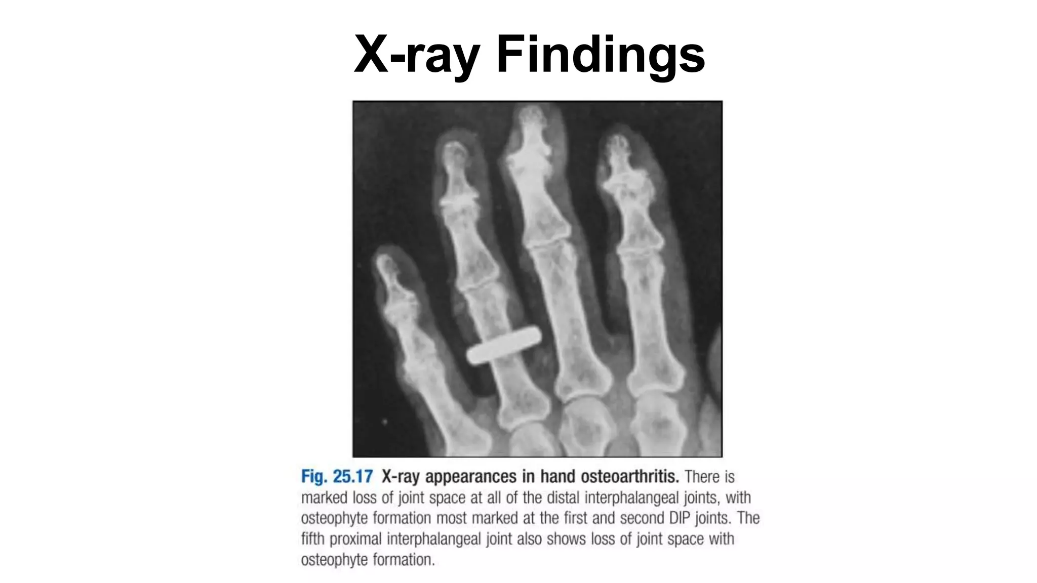 X-ray Findings
 