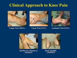 Clinical Approach to Knee Pain




Valgus Test (MCL)     Varus Test (LCL)     Lachman Test (ACL)




           McMurray Maneuver        Duck Waddle
               (menisci)              (stability)
 