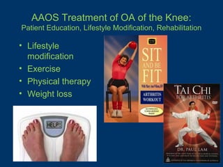 AAOS Treatment of OA of the Knee:
Patient Education, Lifestyle Modification, Rehabilitation

• Lifestyle
  modification
• Exercise
• Physical therapy
• Weight loss
 