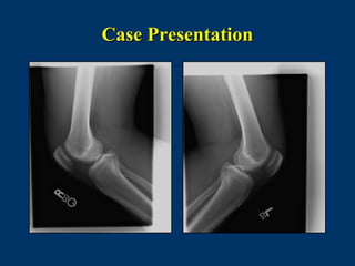 Case Presentation
 