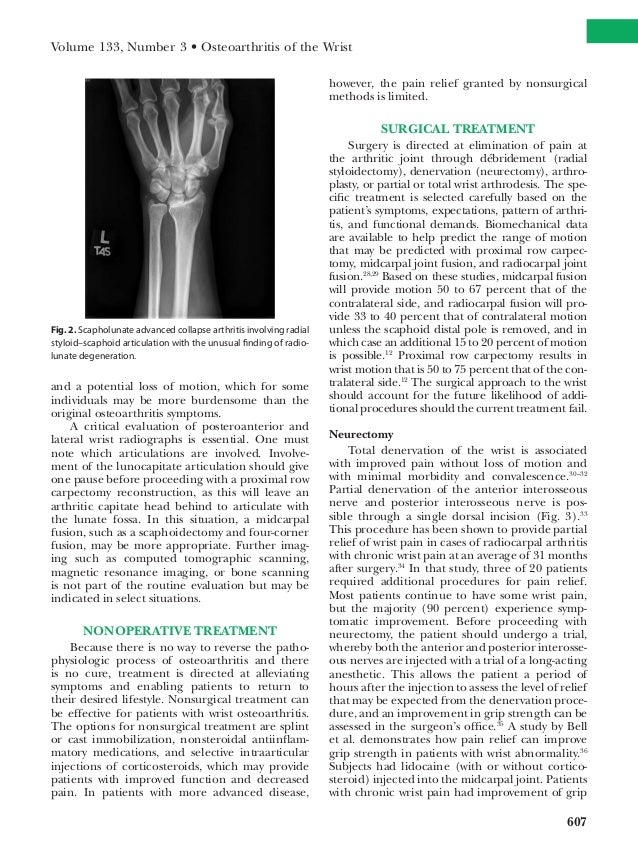 Osteoarthritis of the_wrist from Mayo Clinic