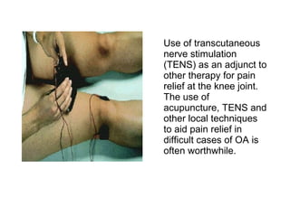 Use of transcutaneous
nerve stimulation
(TENS) as an adjunct to
other therapy for pain
relief at the knee joint.
The use of
acupuncture, TENS and
other local techniques
to aid pain relief in
difficult cases of OA is
often worthwhile.
 