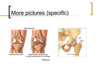 More pictures (specific)
 