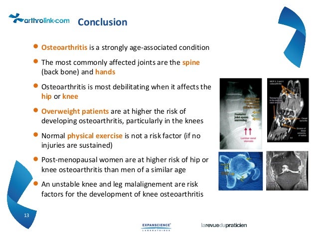 Osteoarthritis risk factors Osteoarthritis risk factors