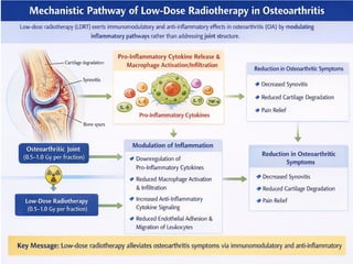 Ldra Vs Rtrt LOW DOSE RADIATHERAPY (LDRT) IN OSTEOARTHRITIS | PPTX