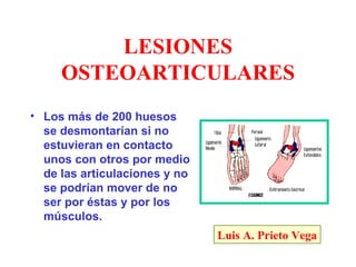 LESIONES
     OSTEOARTICULARES
• Los más de 200 huesos
  se desmontarían si no
  estuvieran en contacto
  unos con otros por medio
  de las articulaciones y no
  se podrían mover de no
  ser por éstas y por los
  músculos.
                               Luis A. Prieto Vega
 