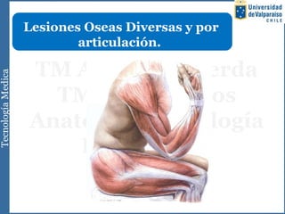 Lesiones Oseas Diversas y por
articulación.
 