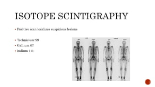 Positive Indium Scan Osteoarticular tuberculosis | PPTX