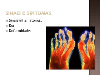  Sinais   inflamatórios;
 Dor
 Deformidades
 
