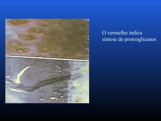 O vermelho indica
síntese de proteoglicanos
 