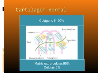 Cartilagem normal
Matriz extra-celular:95%
Células:5%
Colágeno ll- 90%
 