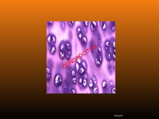 06/03/16
CONDRÓCITOS
 