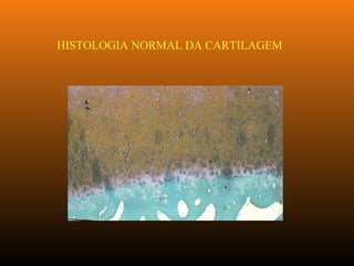 HISTOLOGIA NORMAL DA CARTILAGEM
 
