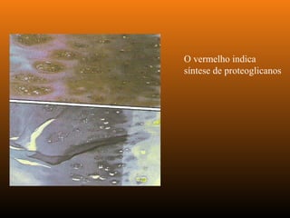 O vermelho indica
síntese de proteoglicanos
 