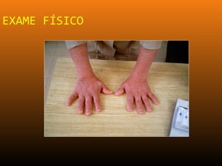 EXAME FÍSICO
 