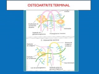OSTEOARTRITE TERMINAL
 